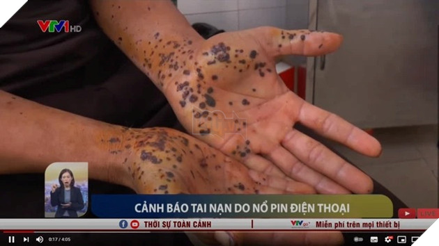 Từng được cảnh báo rất nhiều nhưng những tai nạn do vừa dùng điện thoại vừa sạc vẫn diễn ra 3