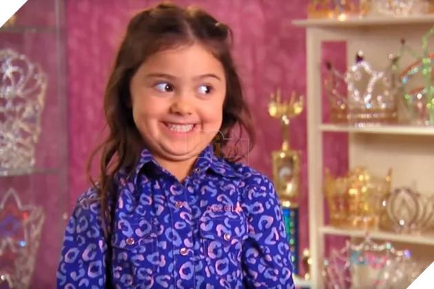 Kailia Posey - Cô bé với khuôn mặt meme nổi tiếng đã qua đời ở tuổi 16 2