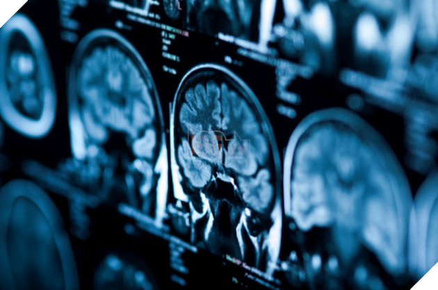 Bạch tuột thông minh đến mức kinh ngạc, khi chúng có chung gen trí tuệ với con người 