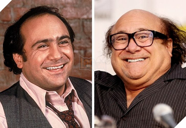 các tài tử điện ảnh nổi tiếng Hollywood bị hói đầu