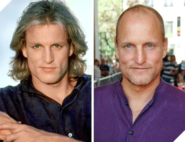 các tài tử điện ảnh nổi tiếng Hollywood bị hói đầu