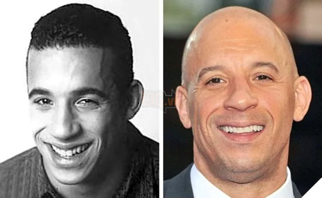 các tài tử điện ảnh nổi tiếng Hollywood bị hói đầu