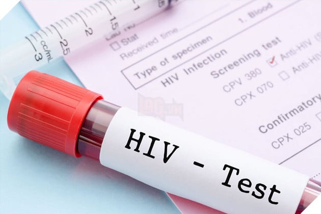 Được chẩn đoán mắc bệnh thế kỷ, nam thanh niên chia tay bạn gái và tiêu hết tiền rồi bị thông báo là nhầm kết quả