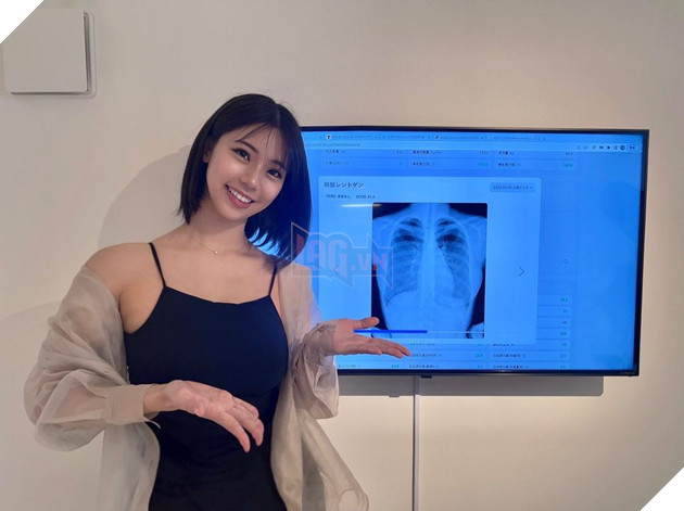 Bị hoài nghi đụng chạm dao kéo, nữ người mẫu quyết định chụp X-ray vòng 1 để chứng mình hàng real