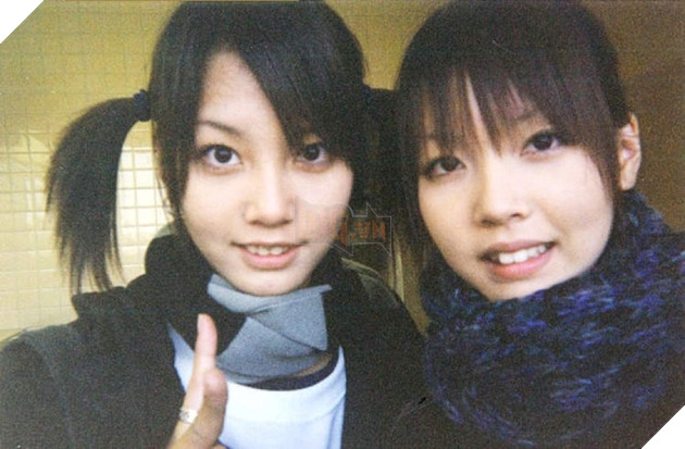 Ngỡ ngàng nhan sắc "vịt hoá thiên nga" của cặp song sinh nghiện phẫu thuật thẩm mỹ