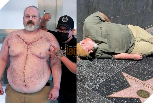 Sự thật về người đàn ông giả làm zombie trong suốt một năm 2