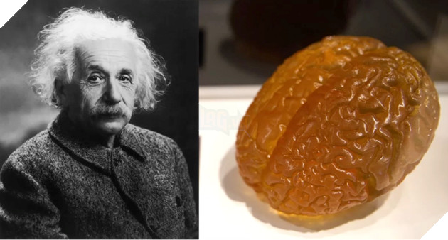 Where is Einstein's brain now? 