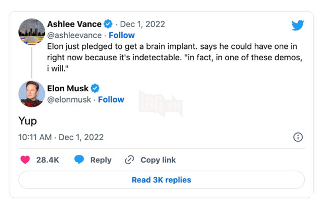 Elon Musk lên kế hoạch tự cấy chip Neuralink vào não của mình 2