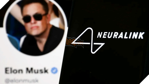 Elon Musk lên kế hoạch tự cấy chip Neuralink vào não của mình