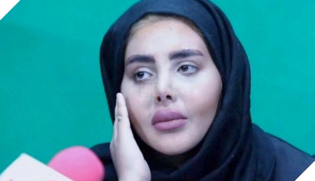 Cô gái phẫu thuật giống Angelina Jolie phiên bản kinh dị đã chính thức được mãn hạn tù