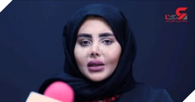 Cô gái phẫu thuật giống Angelina Jolie phiên bản kinh dị đã chính thức được mãn hạn tù