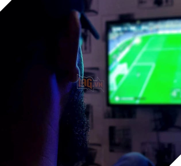 Một người đàn ông bị liệt nửa mặt sau khi thức suốt một tuần để xem World Cup