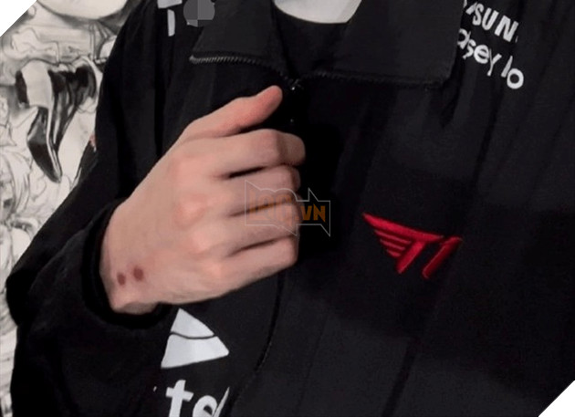 LMHT: Fan phát hiện Faker vẫn còn gặp chấn thương trong quá trình thi đấu