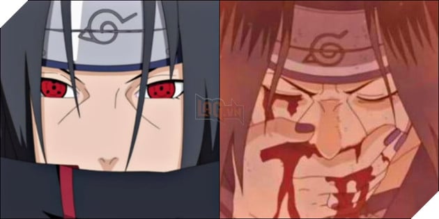 Điểm mặt những nhân vật Anime rất mạnh nhưng lại mắc những căn bệnh nan y