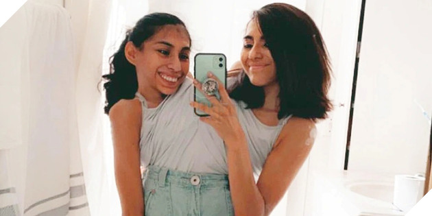 Song sinh dính liền