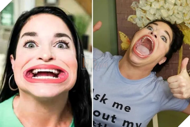 Cô gái kiếm được hơn 300 triệu cho mỗi bài đăng TikTok nhờ vào chiếc miệng rộng kỷ lục