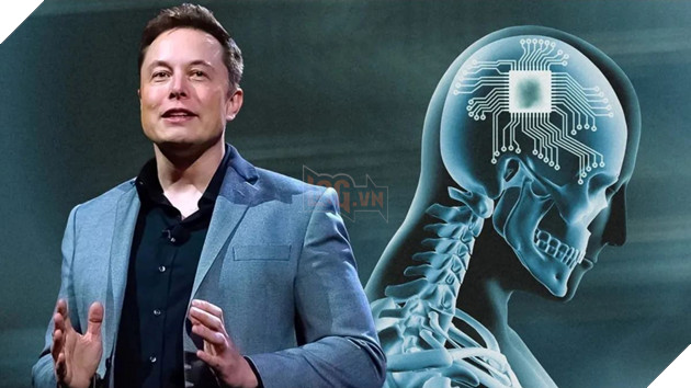 Neuralink sẵn sàng thí nghiệm trên người, bất chấp lệnh cấm từ chính phủ Mỹ