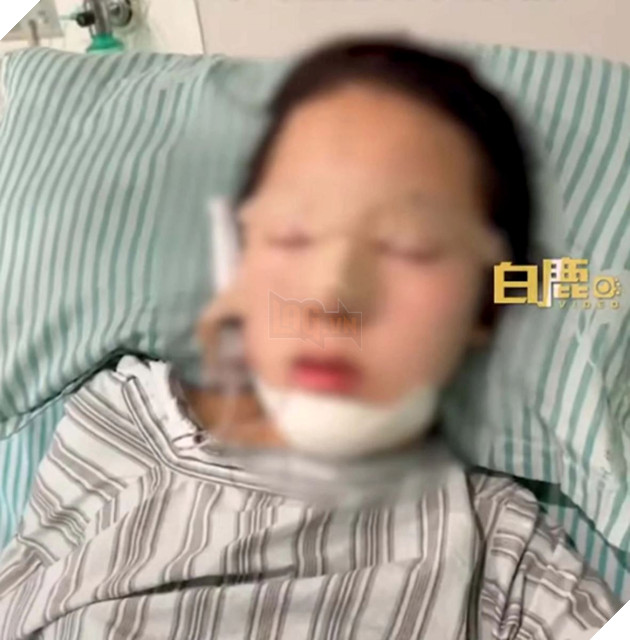 Độc lạ Trung Quốc cho con gái phẫu thuật thẩm mỹ để chữa nghiện game