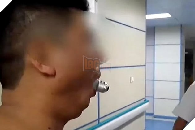Người đàn ông kẹt bóng đèn trong miệng vì thực hiện thử thách ngớ ngẩn trên mạng