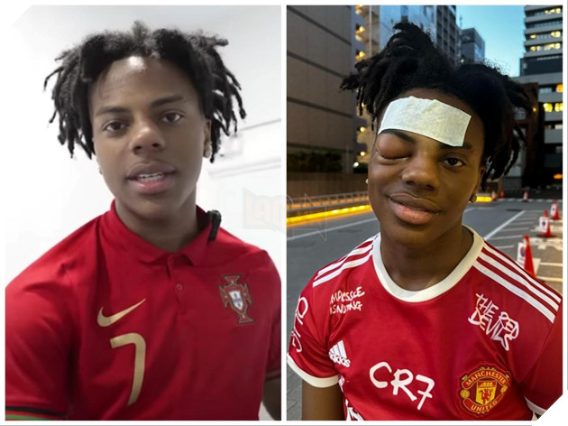 Nam streamer vỡ òa xúc động khi được fan giúp đỡ khi phải đối mặt với viện phí 1,4 tỷ đồng