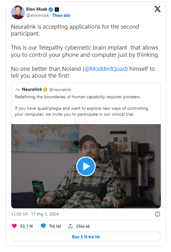 Neuralink Chuẩn Bị Thử Nghiệm Cấy Chip Não Lên Bệnh Nhân Thứ 2