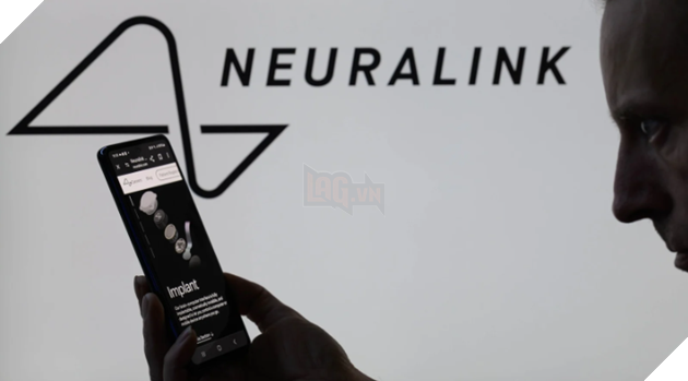 Neuralink Chuẩn Bị Thử Nghiệm Cấy Chip Não Lên Bệnh Nhân Thứ 2