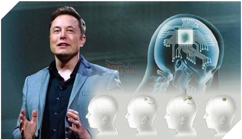 Elon Musk dự đoán tiến trình cấy chip não người sau 20 năm tới