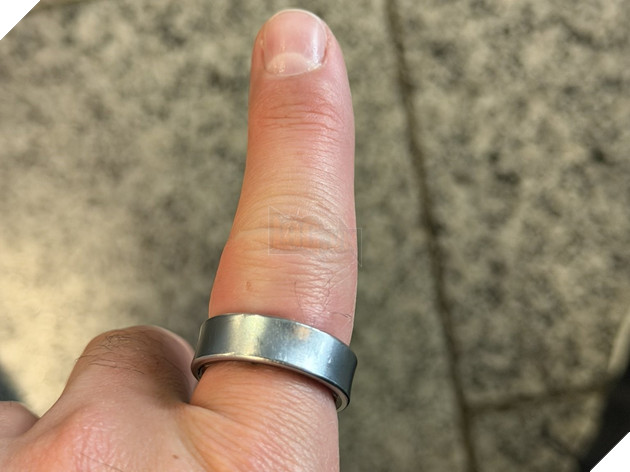 Samsung Galaxy Ring gặp sự cố phồng pin, kẹp chặt tay người dùng khiến lỡ chuyến bay và nhập viện