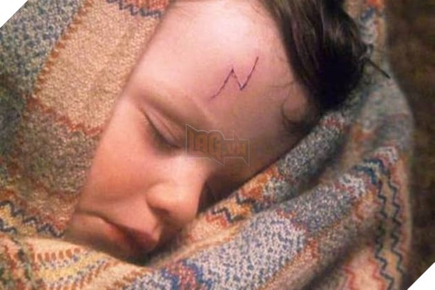 Hình ảnh vết sẹo của nhân vật Harry Potter khi còn nhỏ trong loạt phim của Daniel Radcliffe.